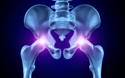 9 Signs You Shouldn’t Ignore Your Hip Pain (Seek Relief Instead!)