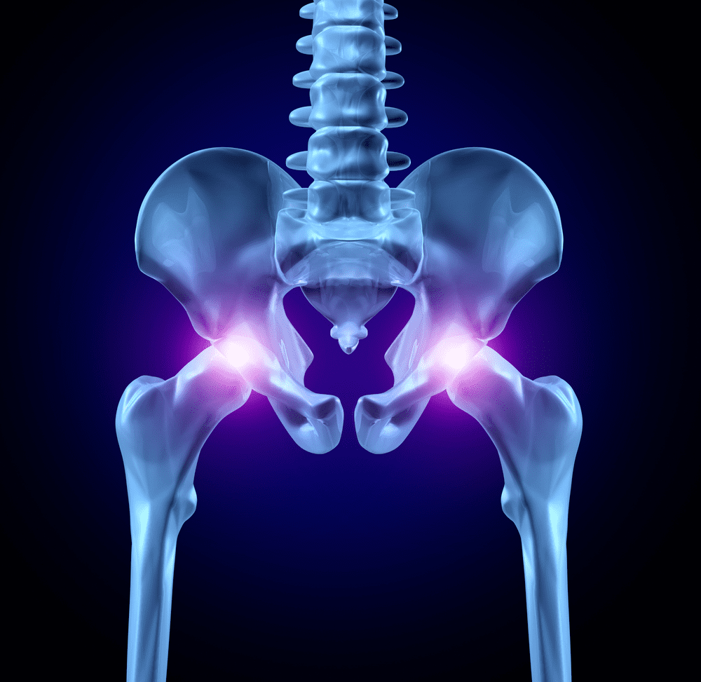 Causes of Hip Pain in Females, Columbus, OH