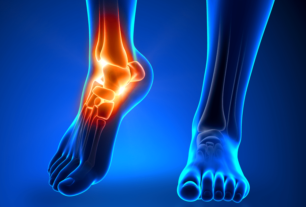 How Can You Get Rid of Ankle Pain
