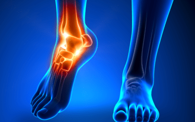How Can You Get Rid of Ankle Pain?